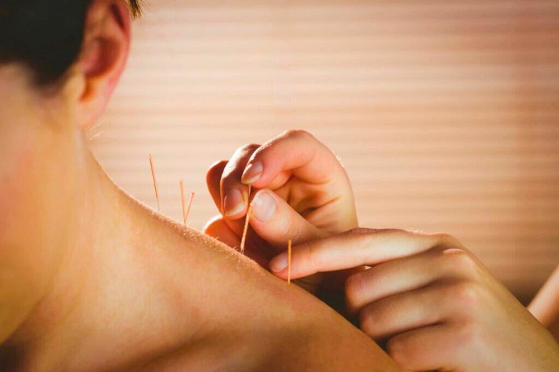 Sous la légèreté des aiguilles, le corps s’ouvre, l’énergie vitale circule et la sérénité s’installe